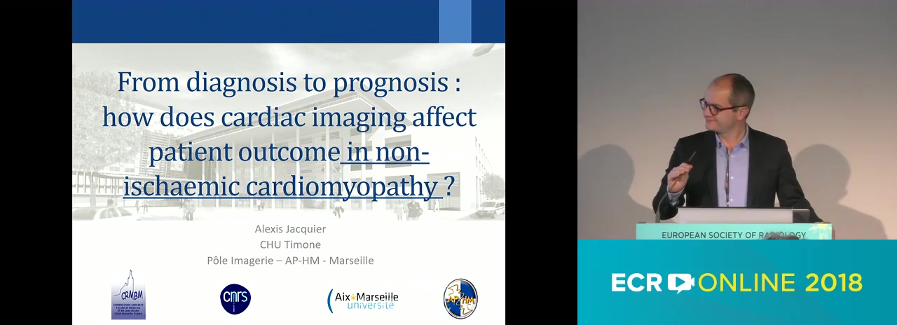 in non-ischaemic cardiomyopathy         a.