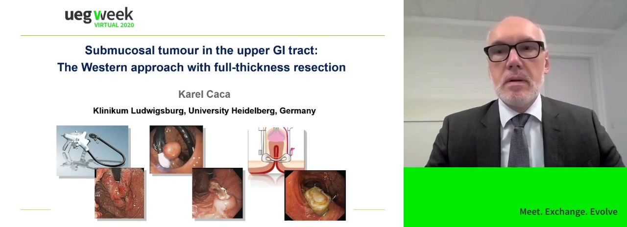 Submucosal tumour in the upper GI tract: The Western approach with full-thickness resection
