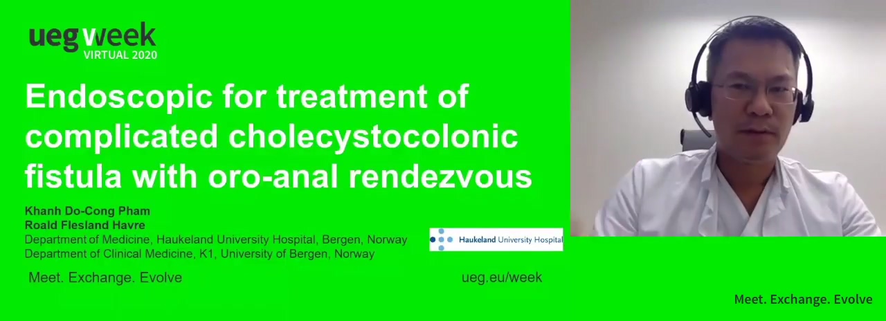 ENDOSCOPIC FOR TREATMENT OF COMPLICATED CHOLECYSTOCOLONIC FISTULA WITH ORO-ANAL RENDEZVOUS