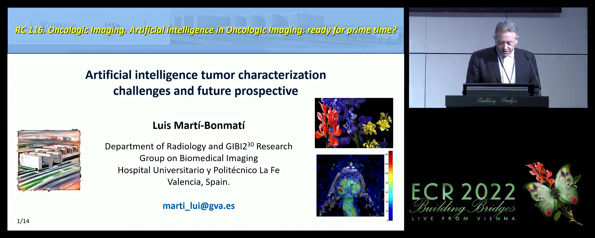 Artificial intelligence tumour characterisation: challenges and future prospective