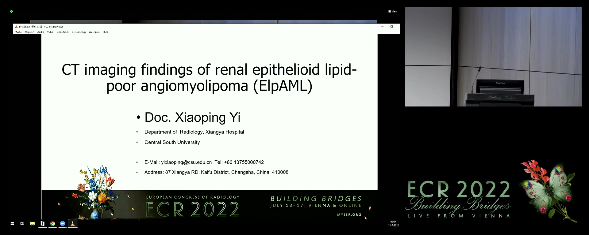 CT imaging findings of renal epithelioid lipid-poor angiomyolipoma