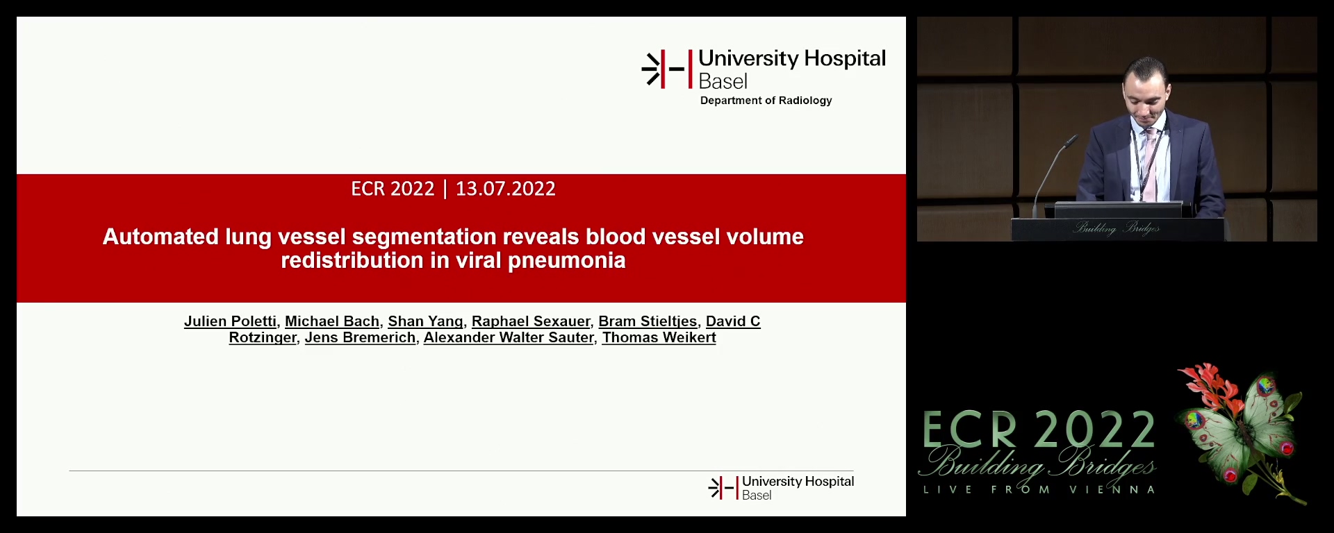 Automated lung vessel segmentation reveals blood vessel volume redistribution in viral pneumonia