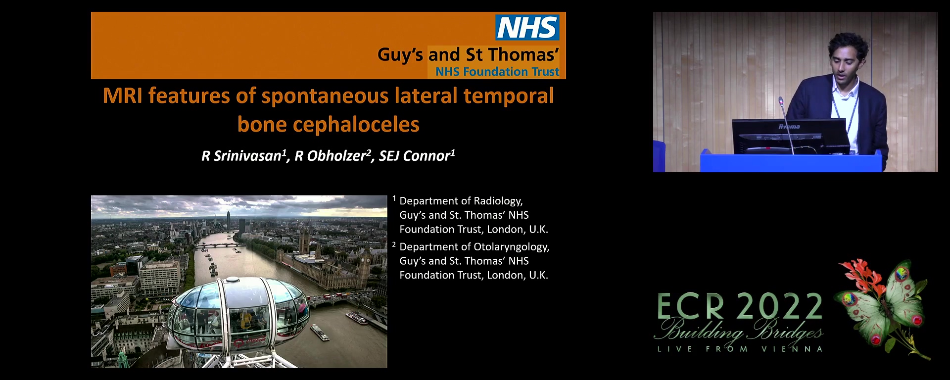 MRI features of spontaneous lateral temporal bone cephaloceles