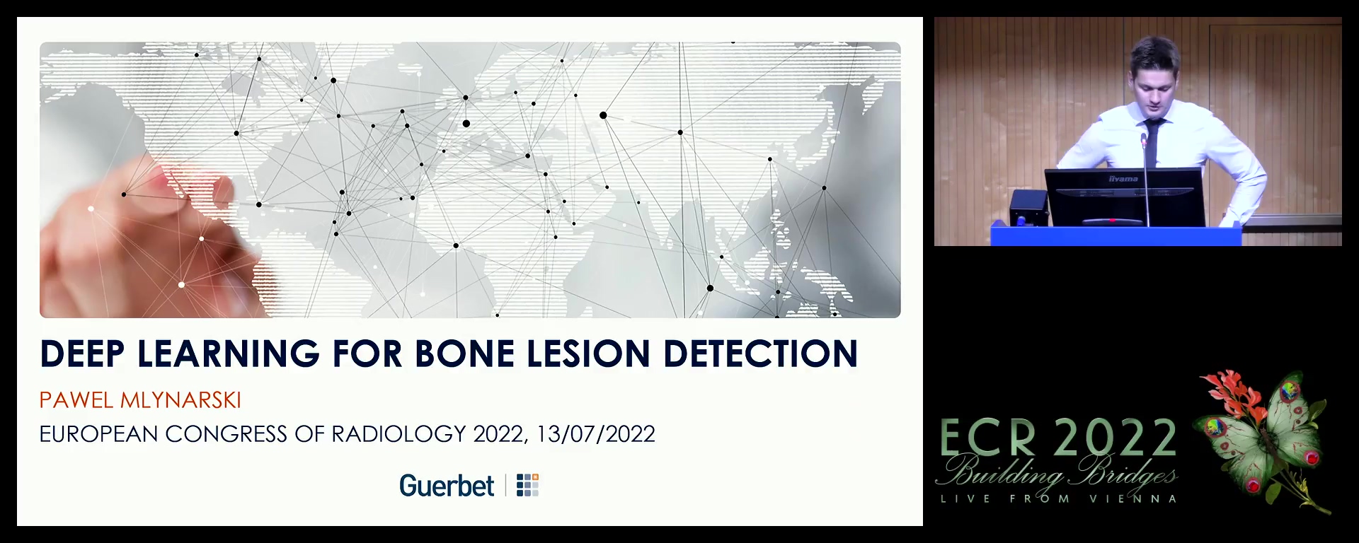 Deep learning for bone lesion detection in CT TAP - Pawel Mlynarski, Paris / FR