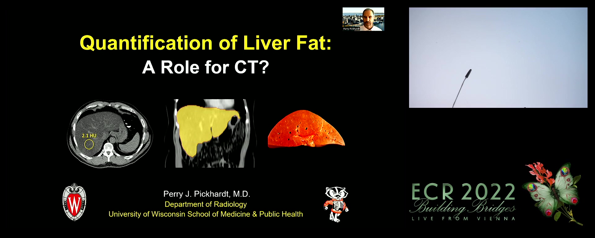 Quantification of fat: a role for CT?