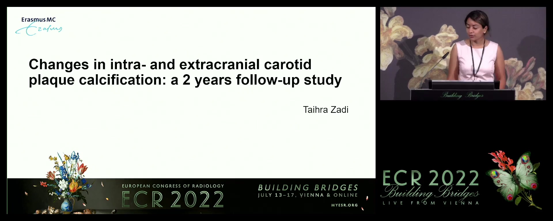 Changes in intra- and extracranial carotid plaque calcification: a 2 years follow-up study - Taihra Zadi, Rotterdam / NL