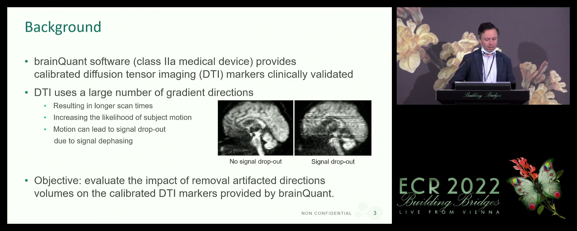 Impact of directions removal on DTI markers used in clinical routine