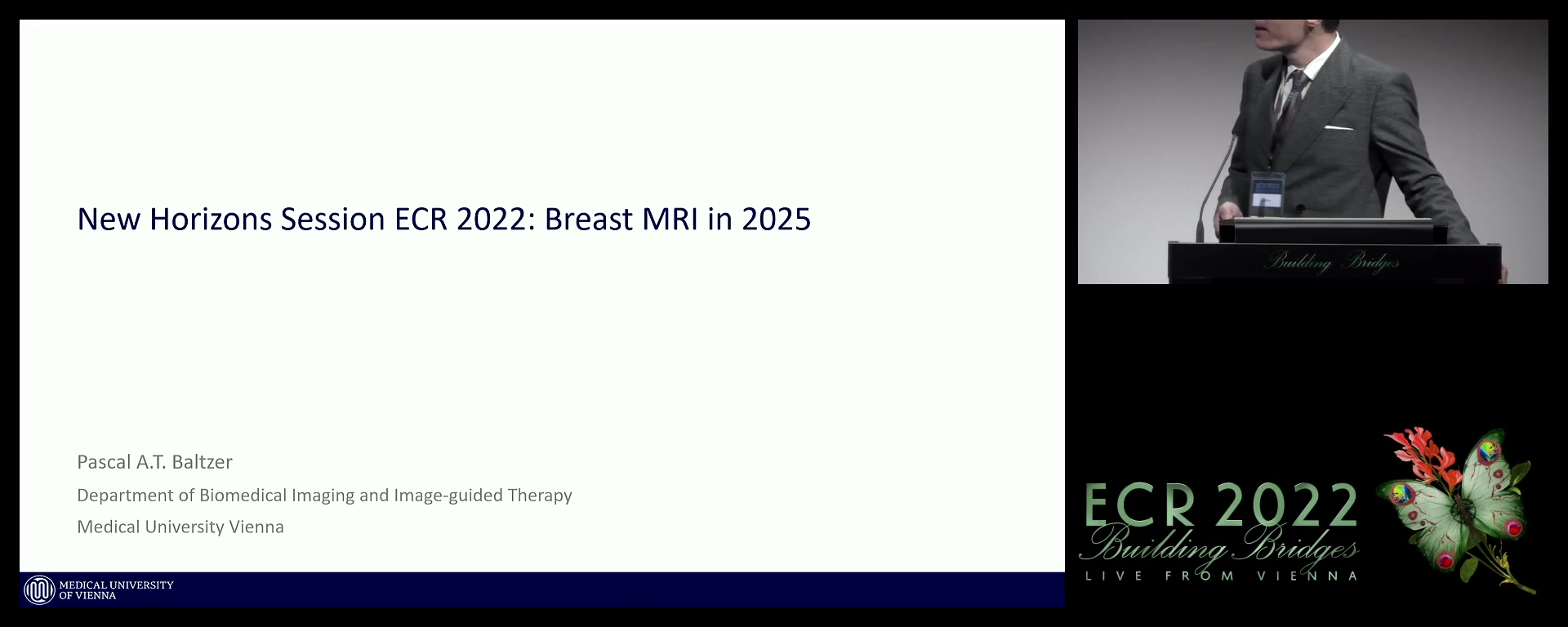 Breast MRI in 2025