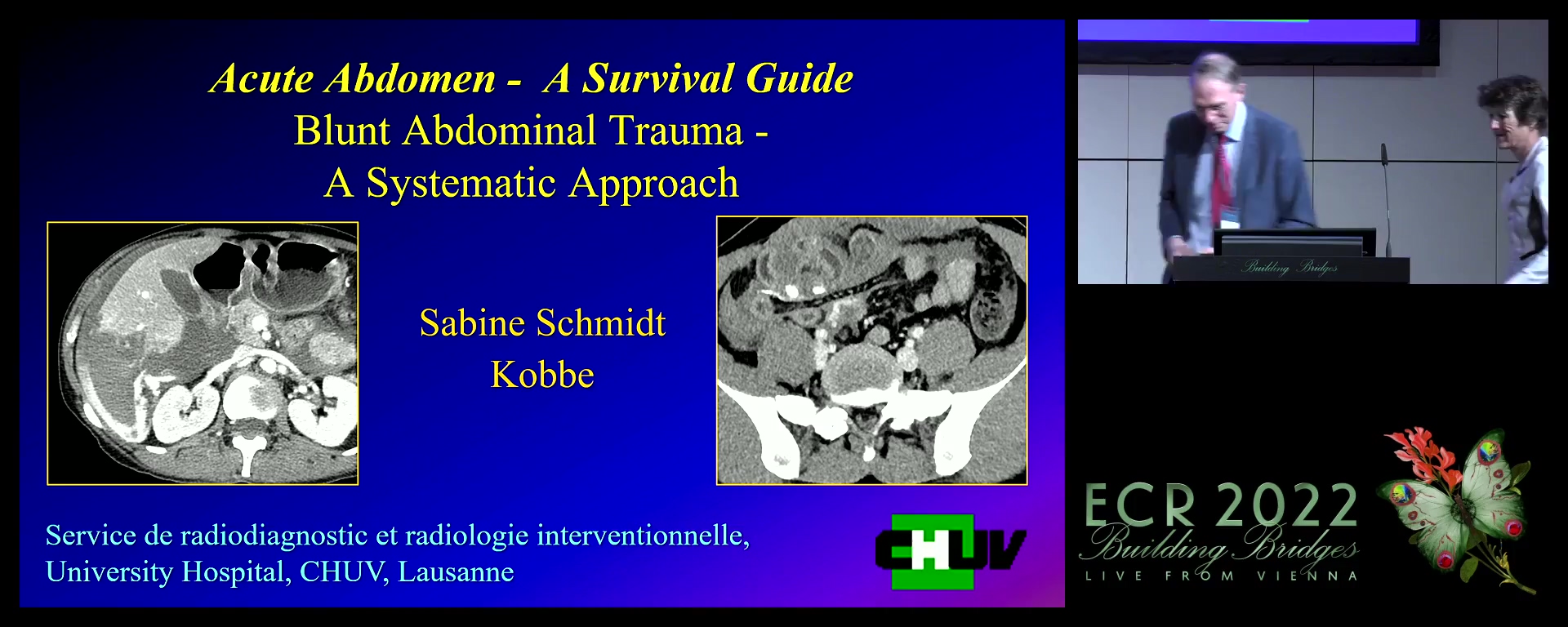 Blunt abdominal trauma: a systematic approach - Sabine Schmidt Kobbe, Lausanne / CH