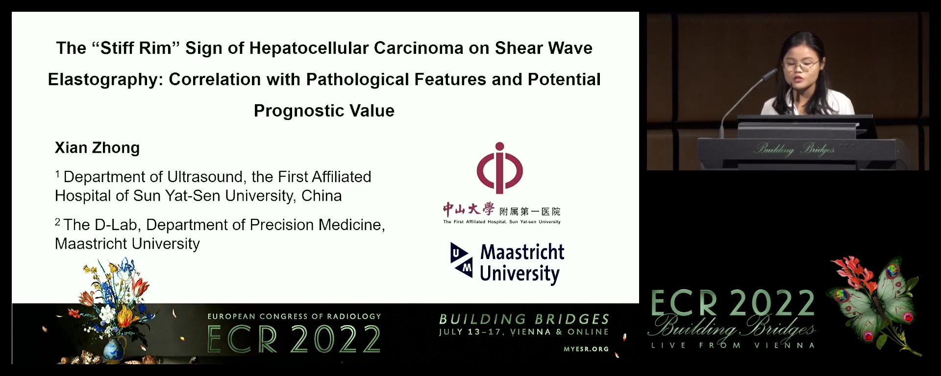 The “stiff rim” sign of hepatocellular carcinoma on shear wave elastography: correlation with pathological features and potential prognostic value