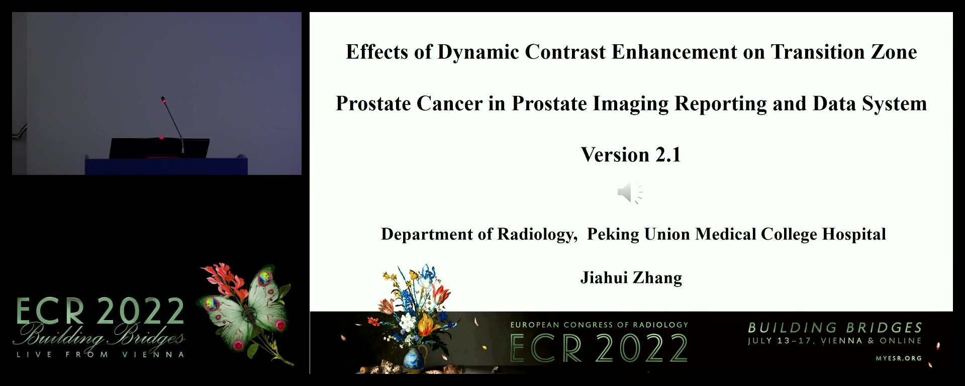 Effects of dynamic contrast enhancement on transition-zone prostate cancer in PI-RADS version 2.1