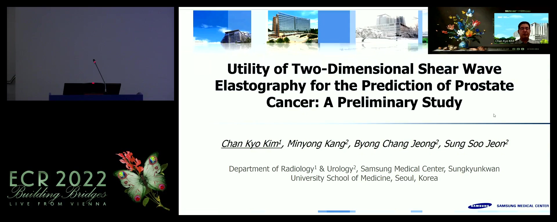 Utility of 2D shear-wave elastography for the detection of prostate cancer: a preliminary study