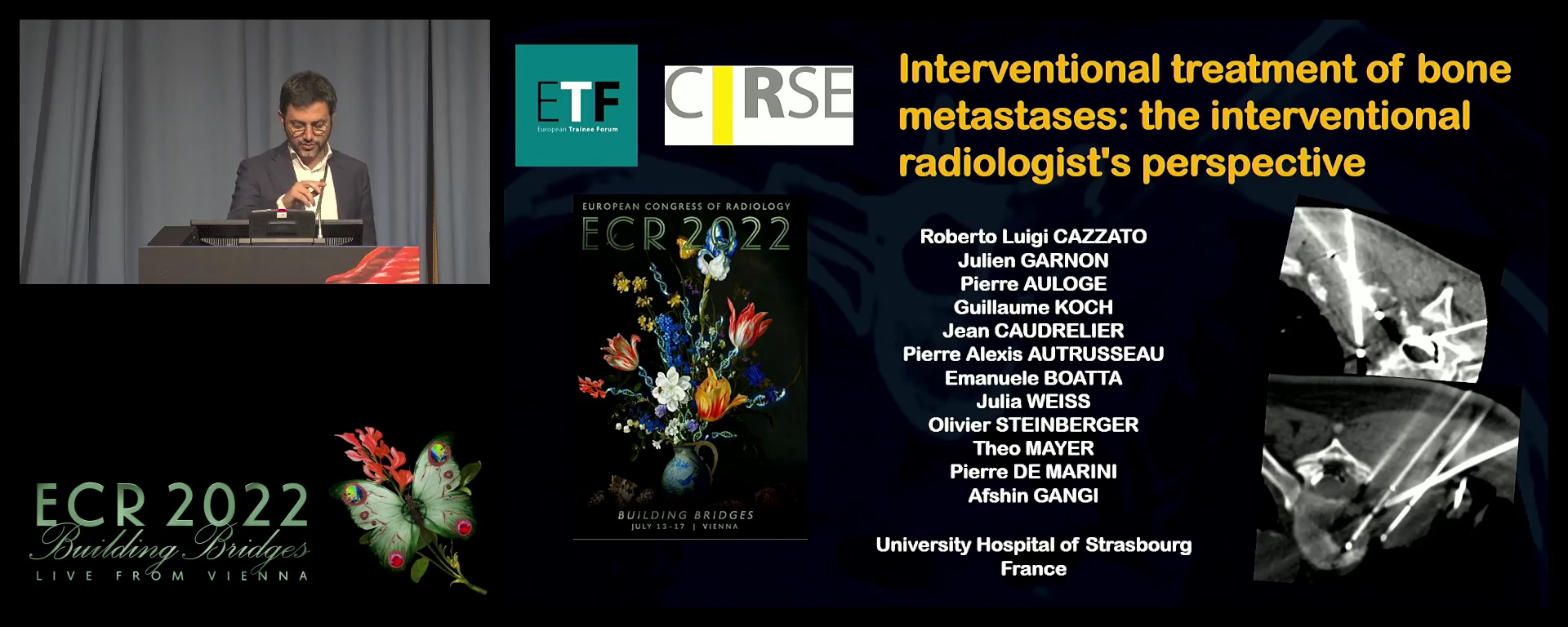 Interventional treatment of bone metastases: the interventional radiologist's perspective