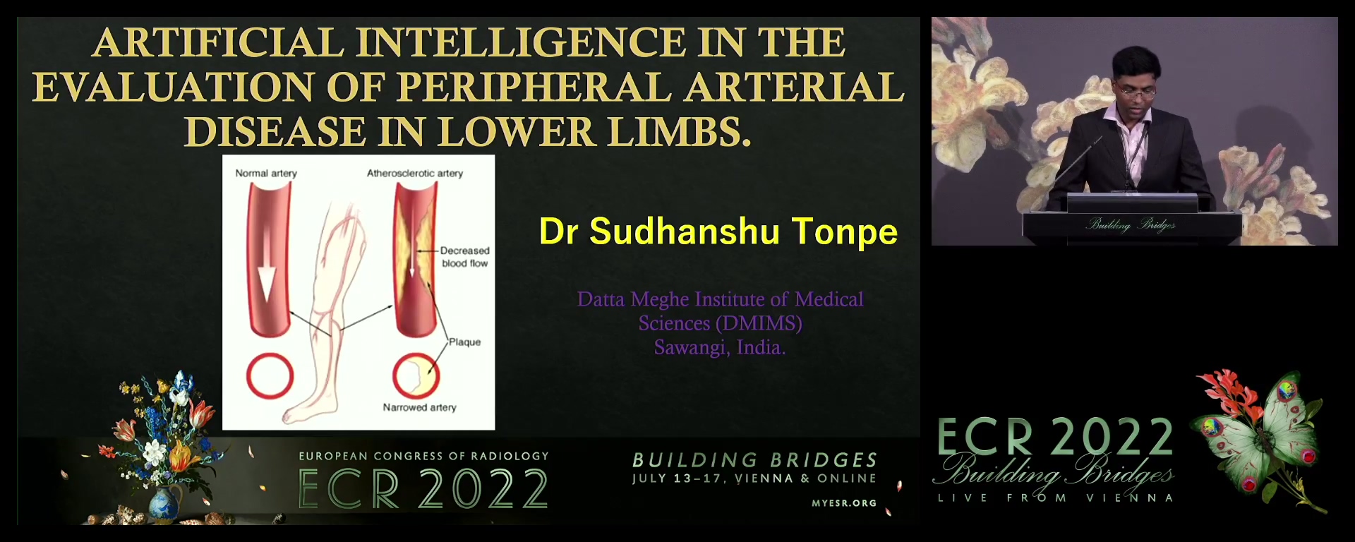 Artificial intelligence in the evaluation of peripheral arterial disease in lower limbs - Sudhanshu Sunil Tonpe, NAGPUR / IN
