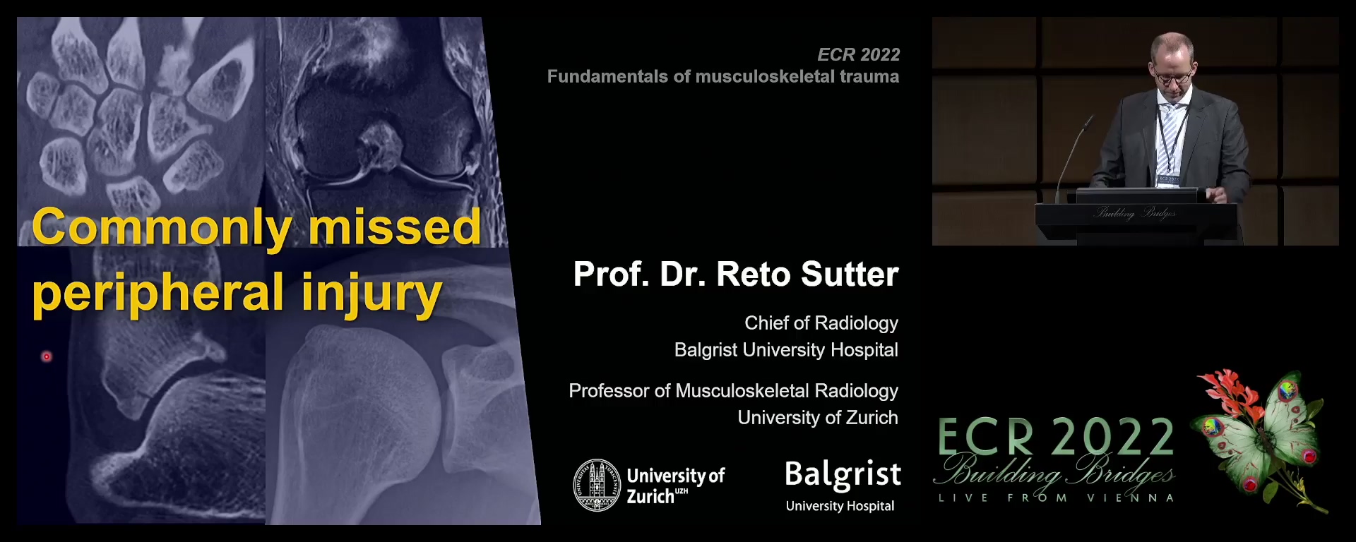 Commonly missed peripheral injury - Reto Sutter, Zurich / CH