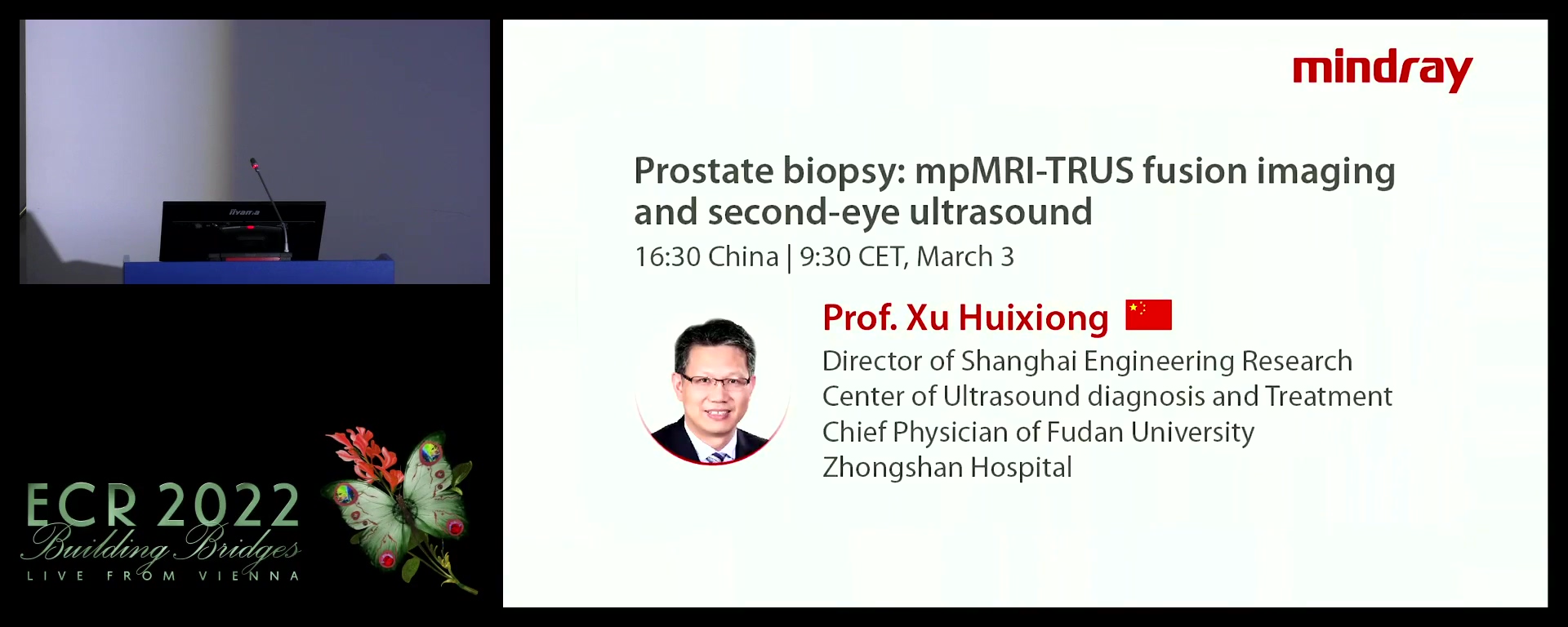 Prostate biopsy: mpMRI-TRUS fusion imaging and second-eye ultrasound & Fusion Ultrasound: A luxury that is becoming a necessity for modern interventions