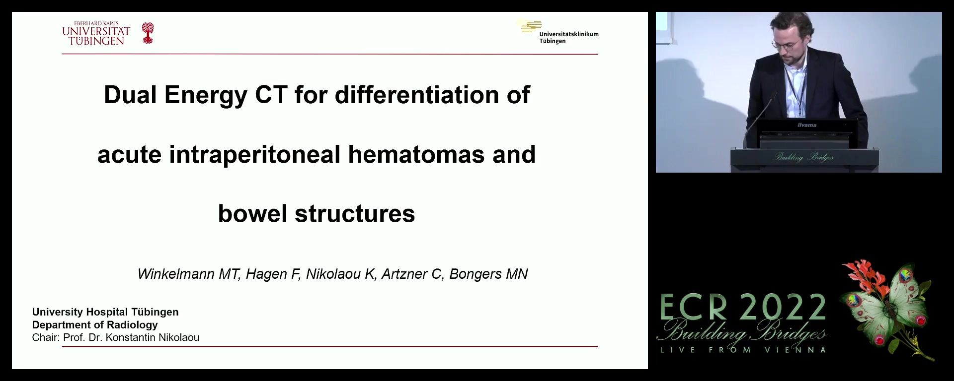 Dual Energy CT for differentiation of intraperitoneal haematoma and bowel structures - Moritz T. Winkelmann, Tuebingen / DE