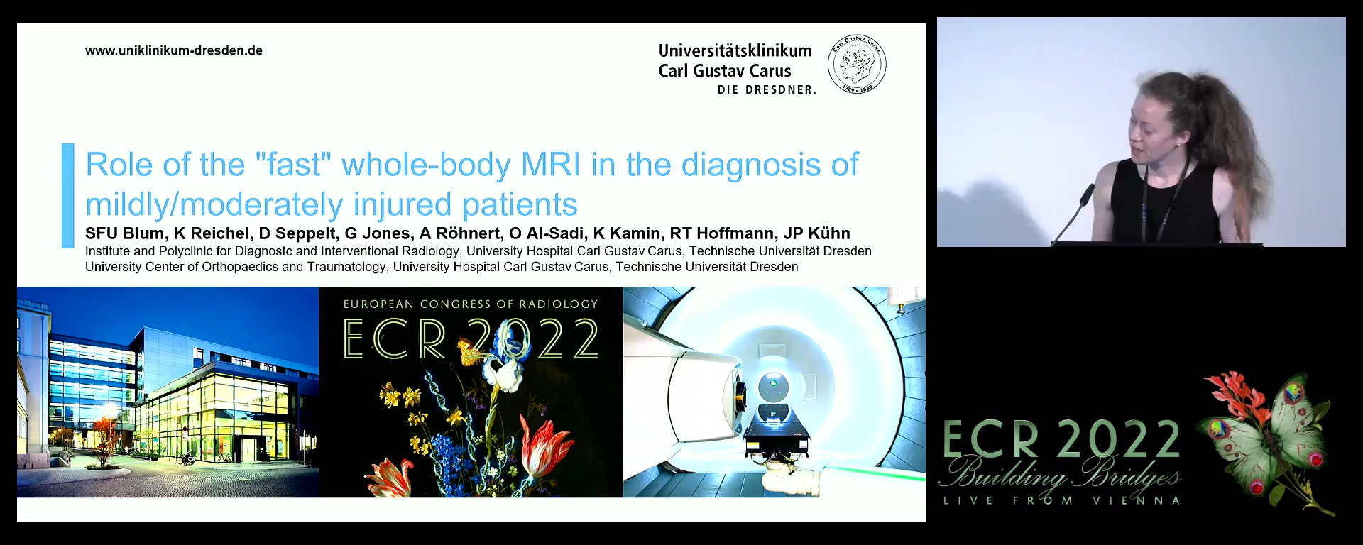 Role of the "fast" whole-body MRI in the diagnosis of mild/moderately injured patients - Sophia Blum, Dresden / DE