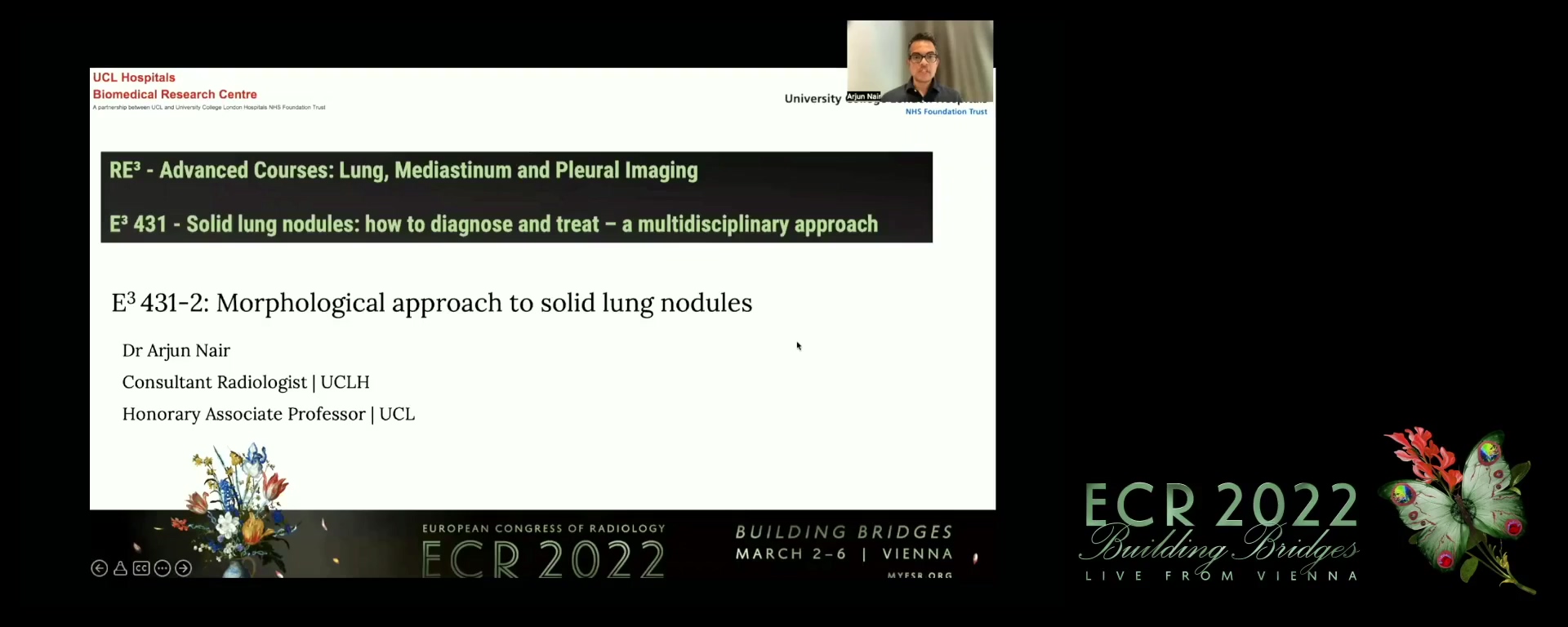 Morphological approach to solid lung nodules