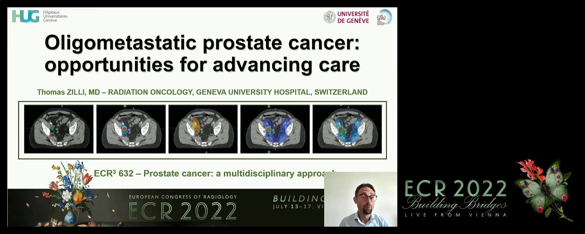 Oligometastatic prostate cancer (OMPC): opportunities for advancing care