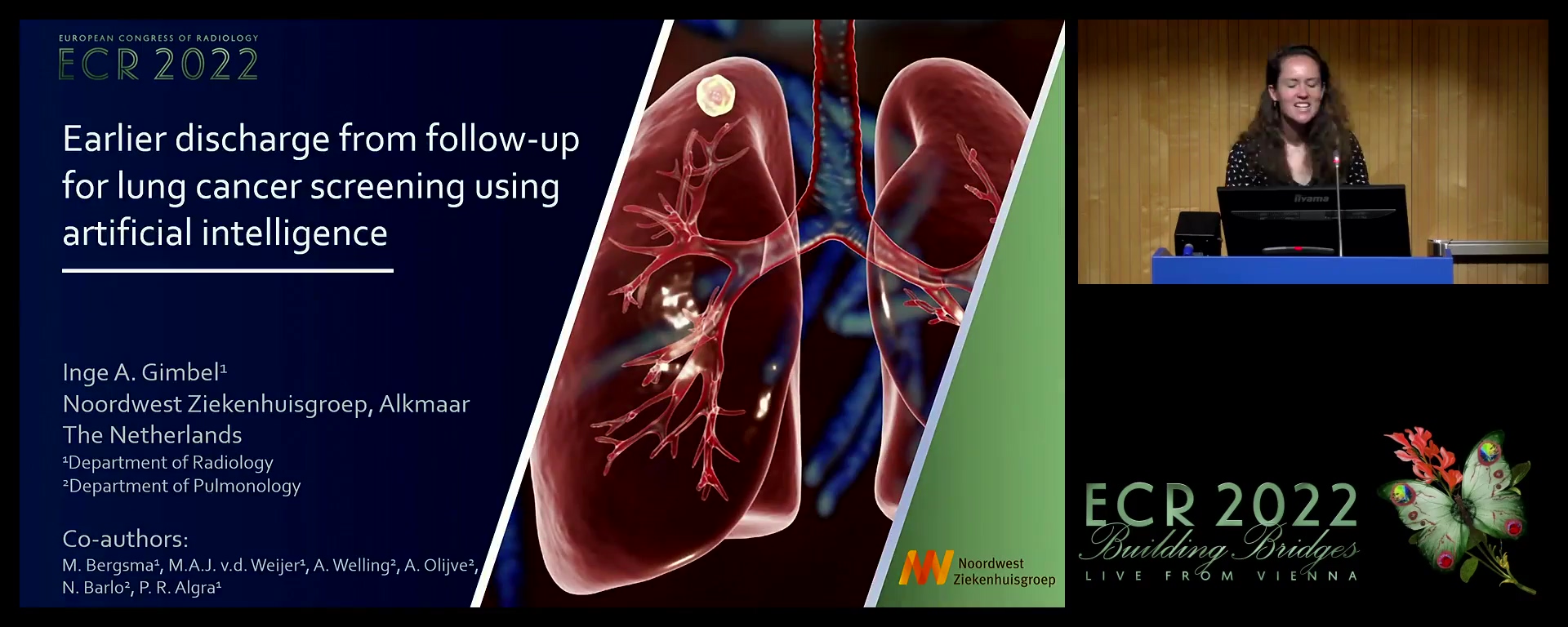 Earlier discharge of patients from follow-up for lung cancer screening using artificial intelligence for detection of pulmonary noduli on computed tomography