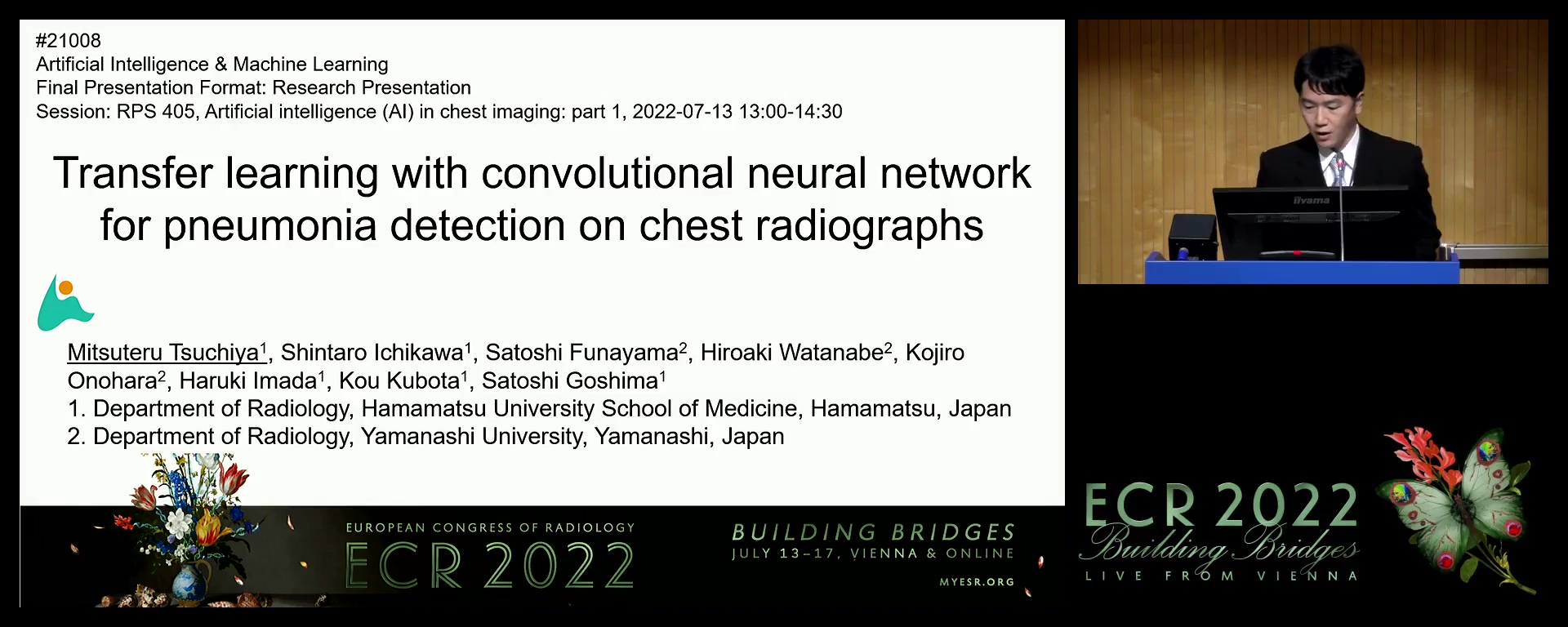 Transfer learning with convolutional neural network for pneumonia detection on chest radiographs