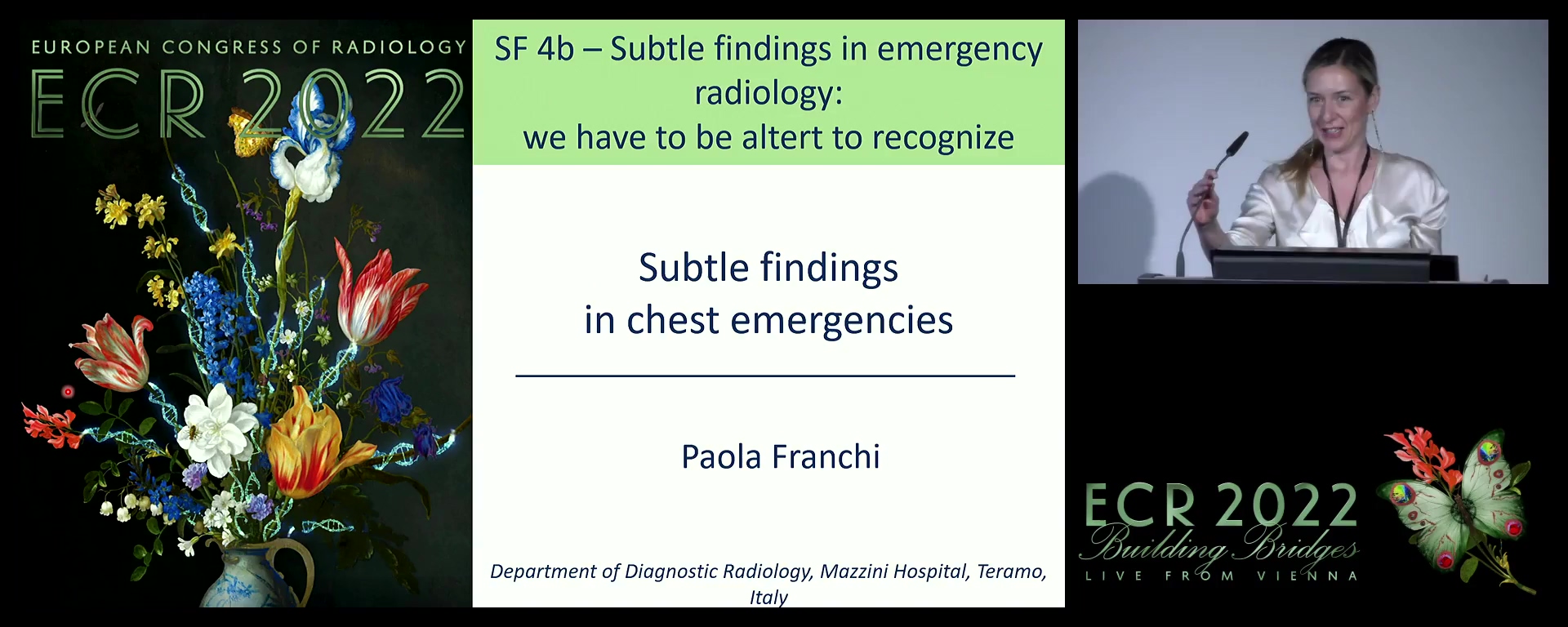 Subtle imaging findings in chest emergencies