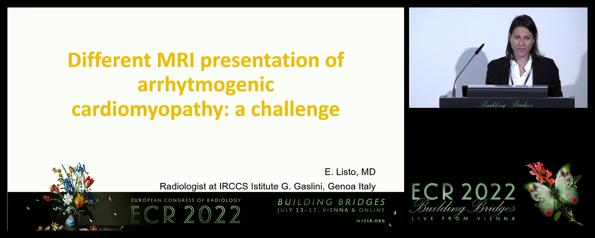 Different MRI presentation of arrhytmogenic cardiomyopathy: a challenge