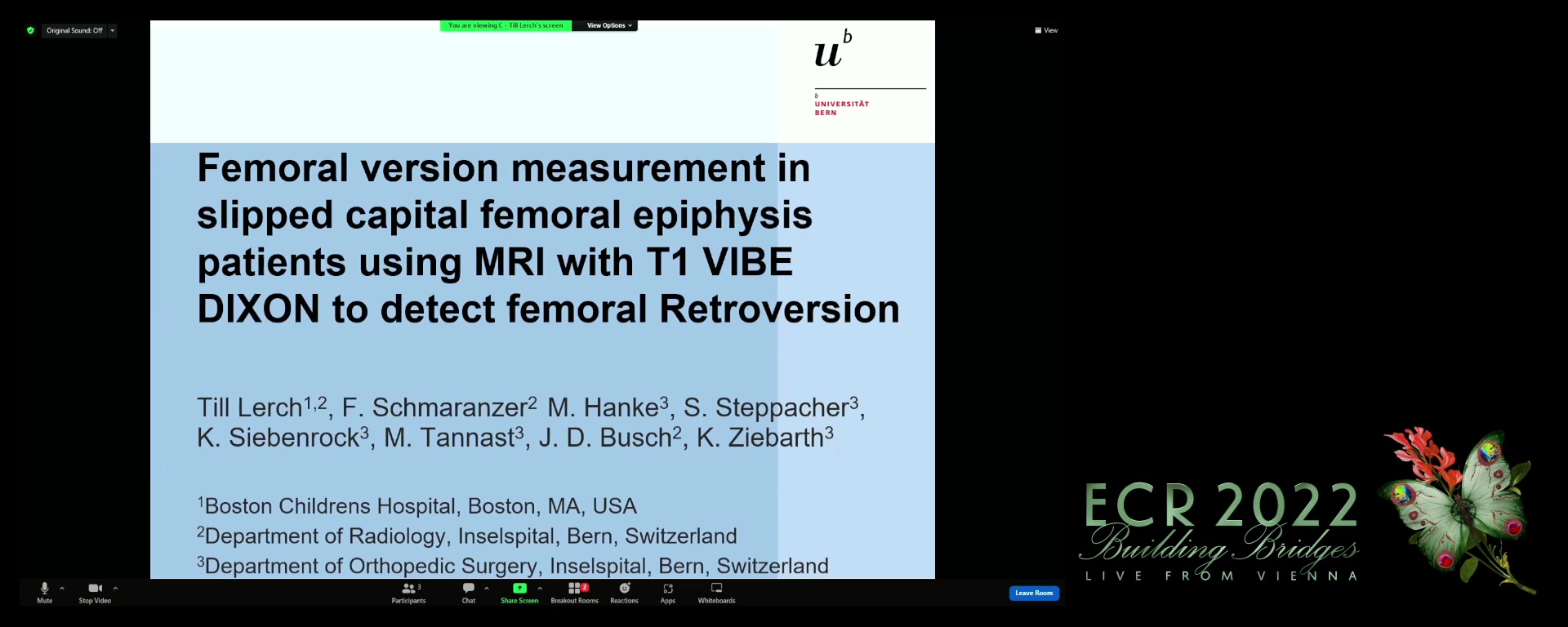 Femoral version measurement in slipped capital femoral epiphysis patients using MRI with T1 VIBE DIXON to detect femoral retroversion