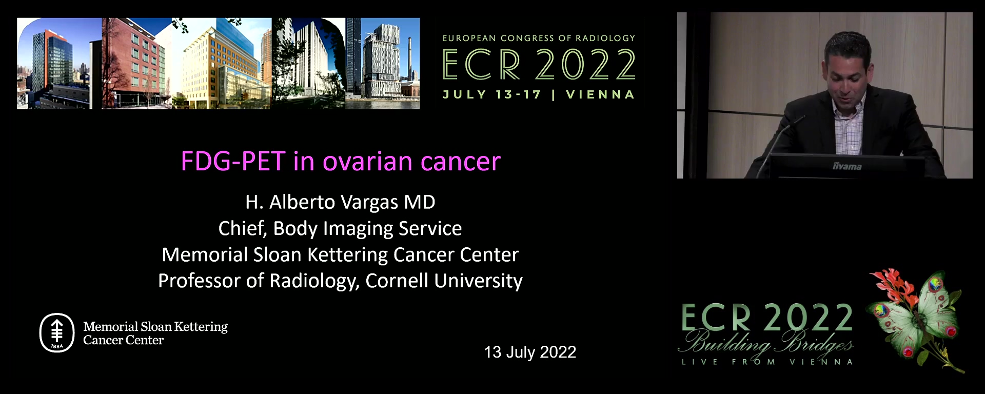 FDG-PET in ovarian cancer