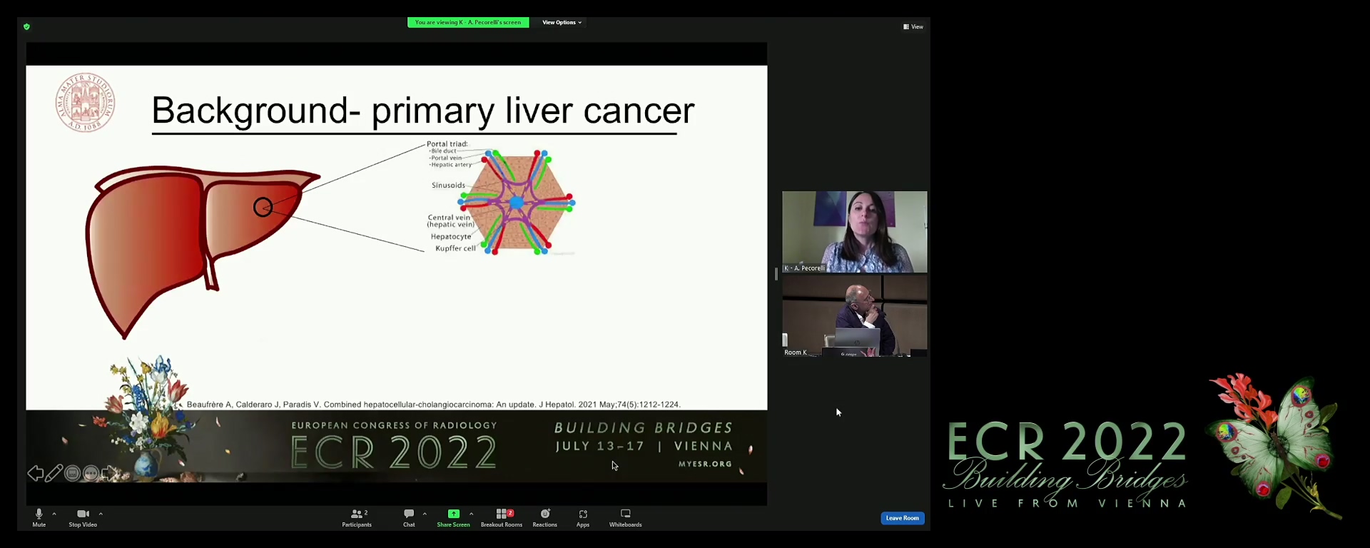 CT features of mixed primary liver cancers with a special focus on the two different histological subtypes