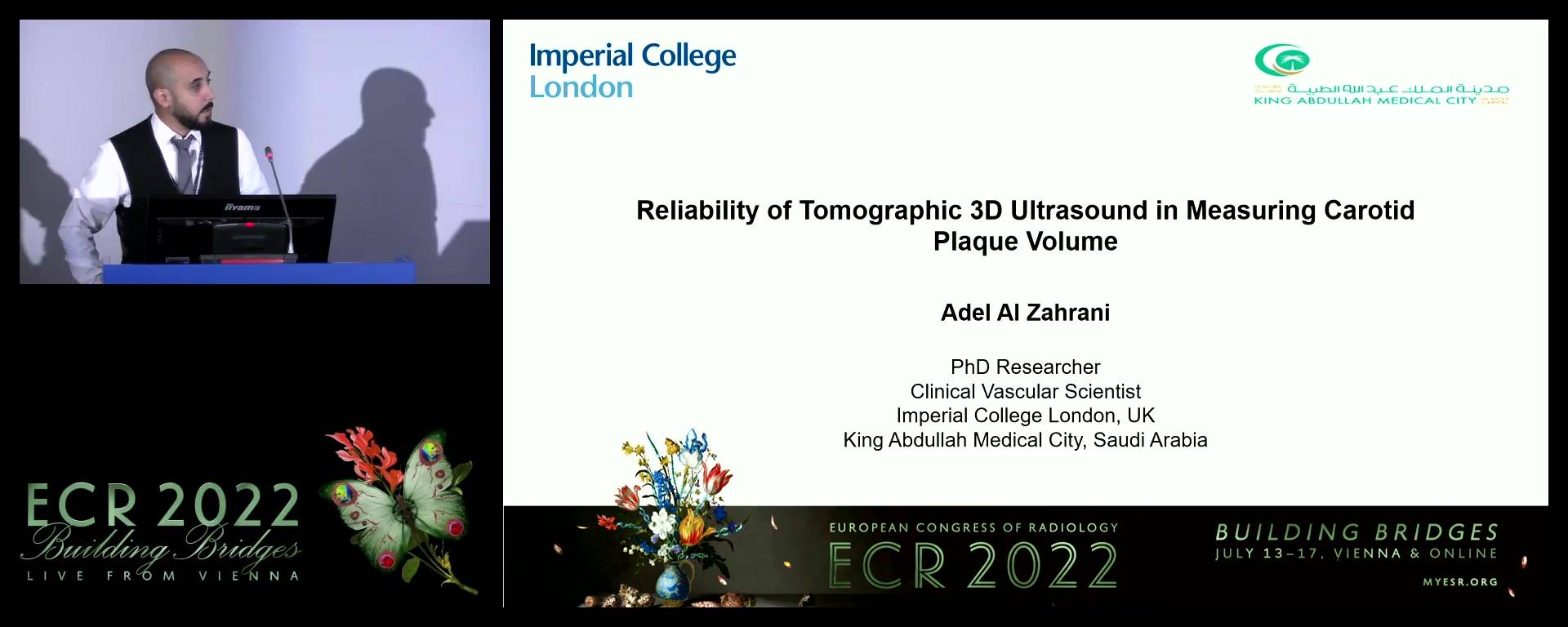 Reliability of Tomographic 3D Ultrasound in measuring carotid plaque volume