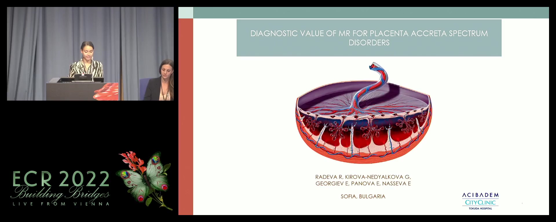 Diagnostic value of MR for placenta accreta spectrum disorders