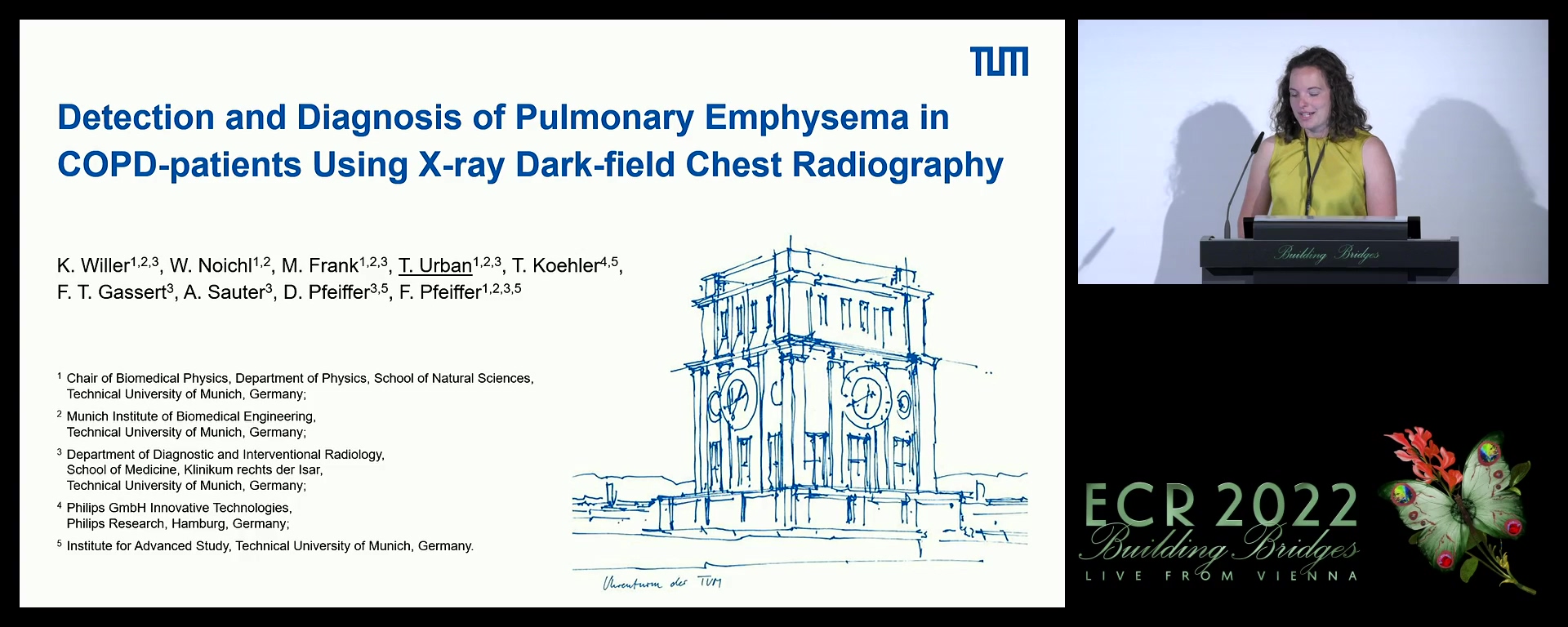 Detection and diagnosis of pulmonary emphysema in COPD-patients using x-ray dark-field chest radiography