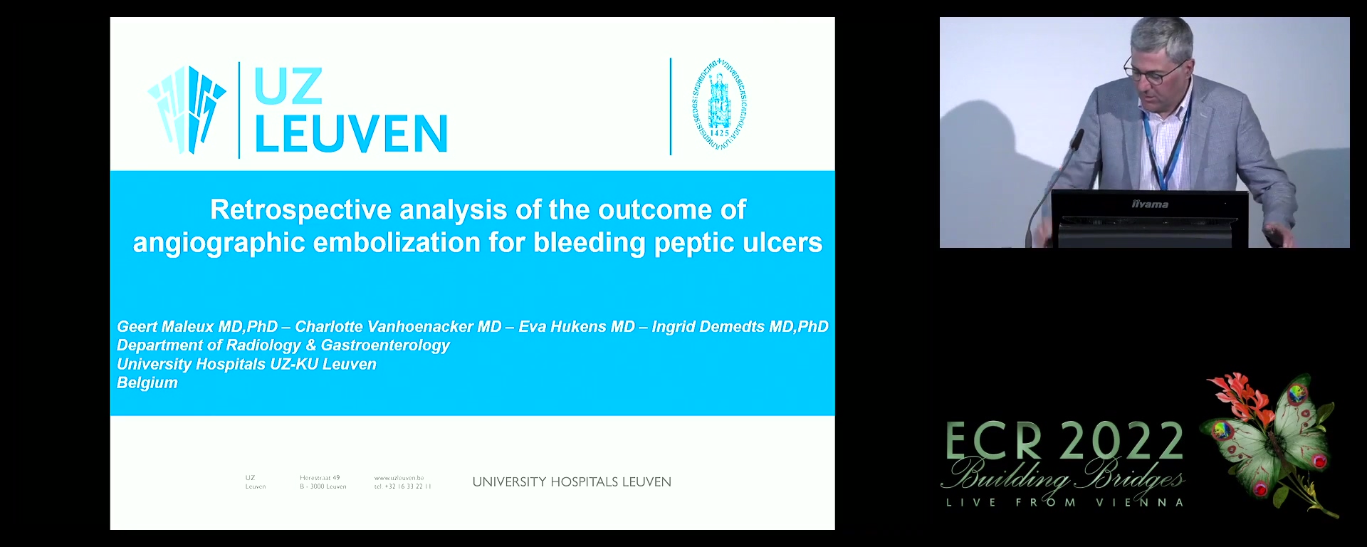 Retrospective analysis of the outcome of angiographic embolisation of peptic ulcers