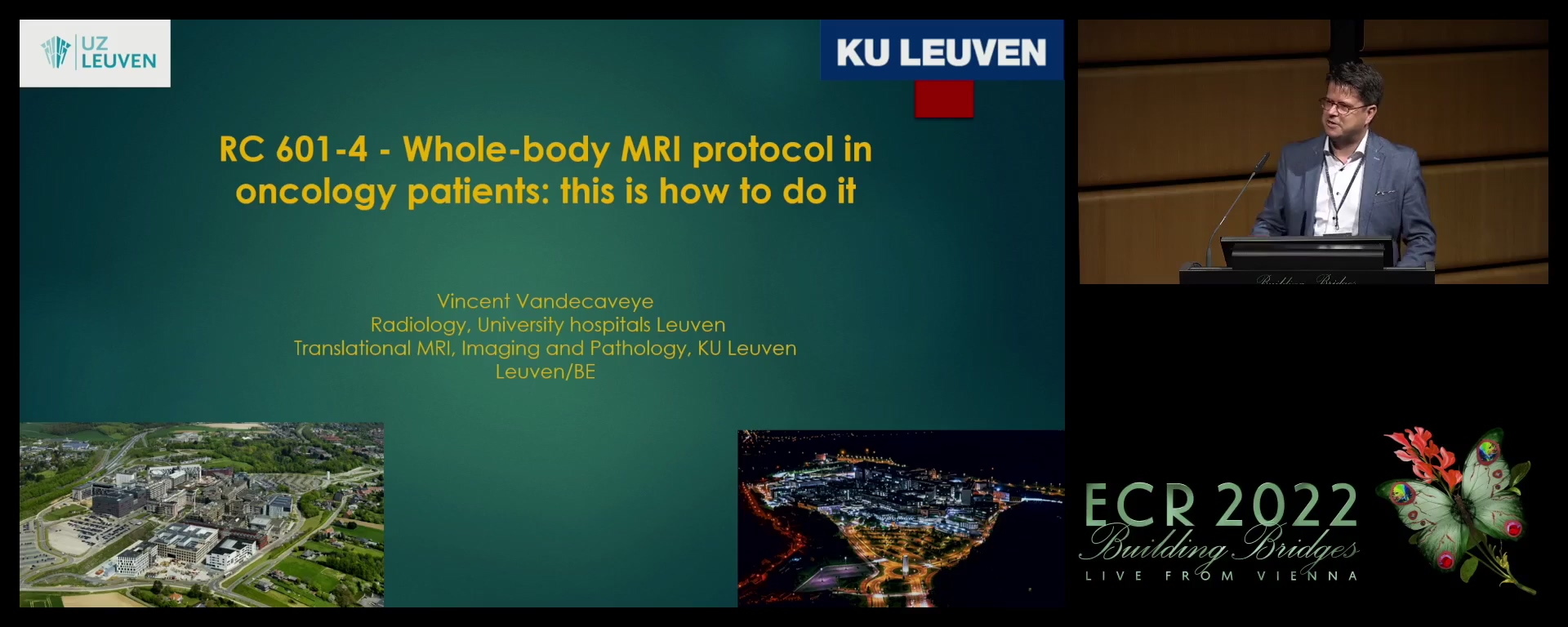 Whole-body MRI protocol in oncology patients: this is how to do it