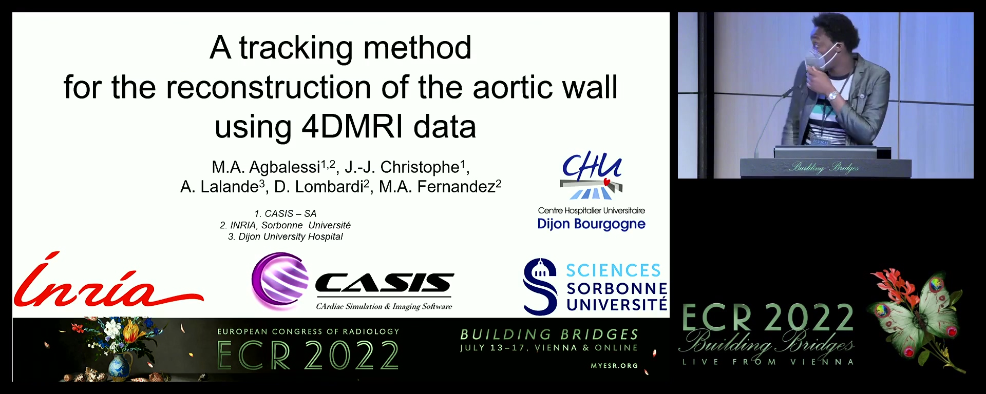 A tracking method for the reconstruction of the aorta wall from 4DMRI data