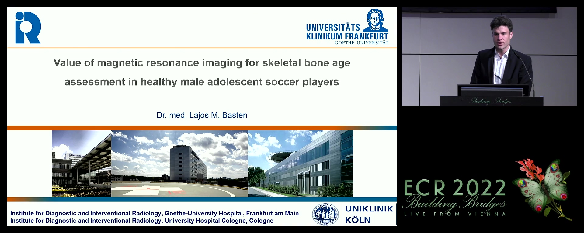 Value of magnetic resonance imaging for skeletal bone age assessment in healthy male adolescent soccer players - Lajos Basten, Köln / DE