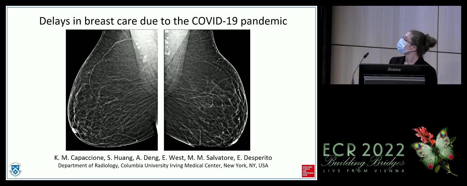 Delays in breast care due to the COVID-19 pandemic