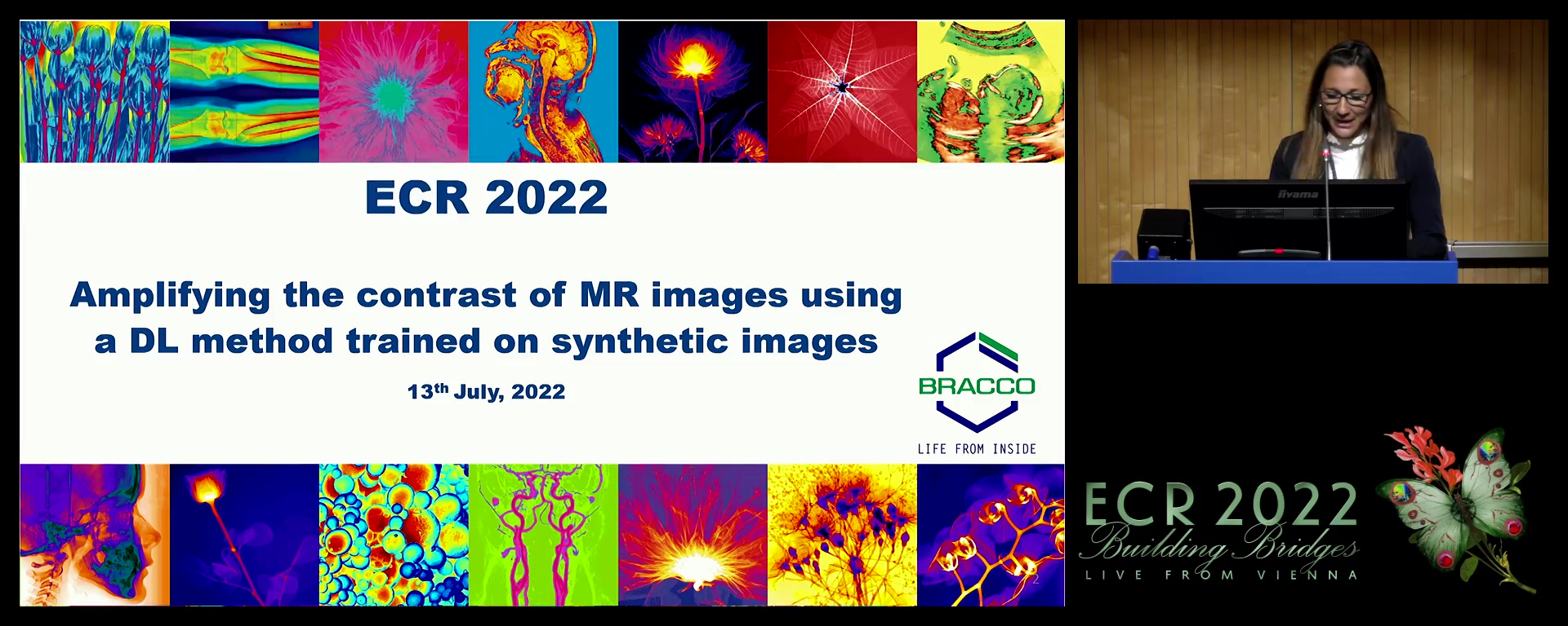 Amplifying the contrast of MR images using a DL method trained on synthetic images