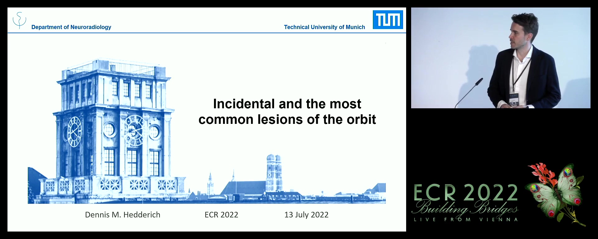 Incidental and the most common lesions of the orbit - Dennis Hedderich, Munich / DE