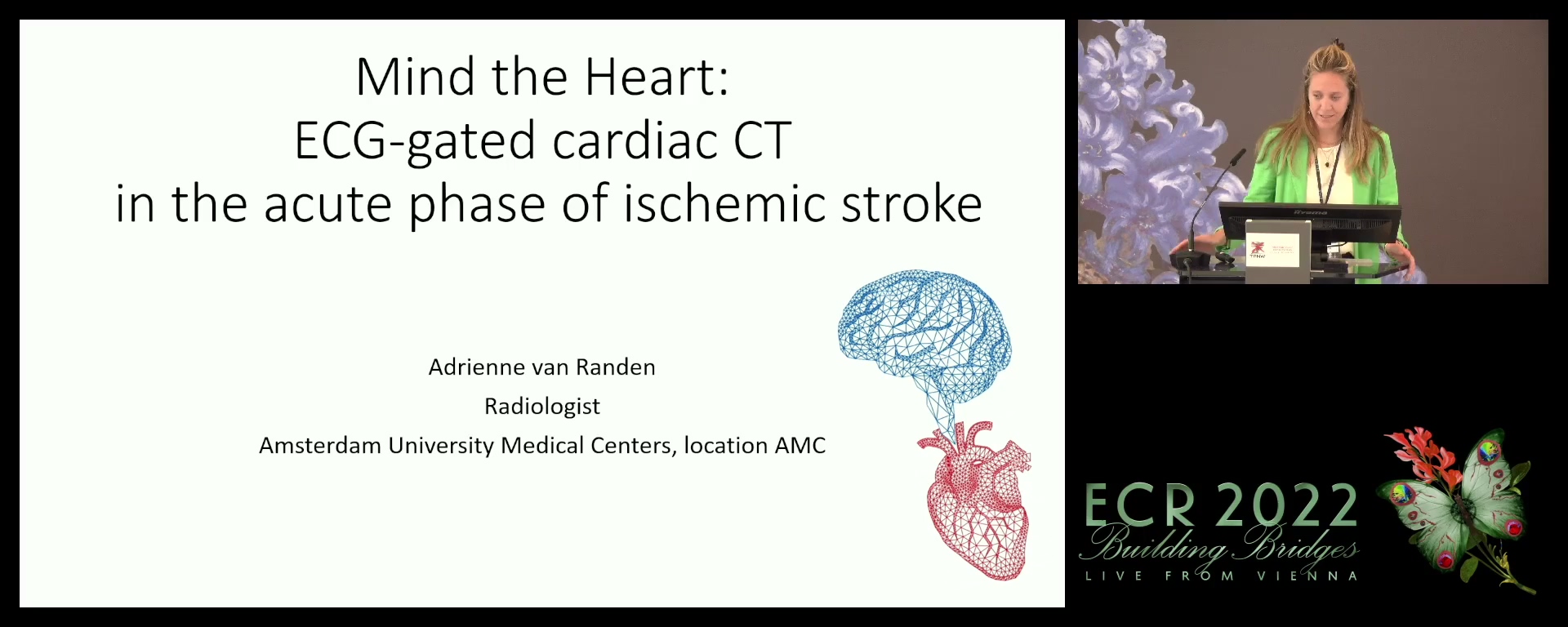 Mind the heart: ECG-gated cardiac CT in the acute phase of ischaemic stroke