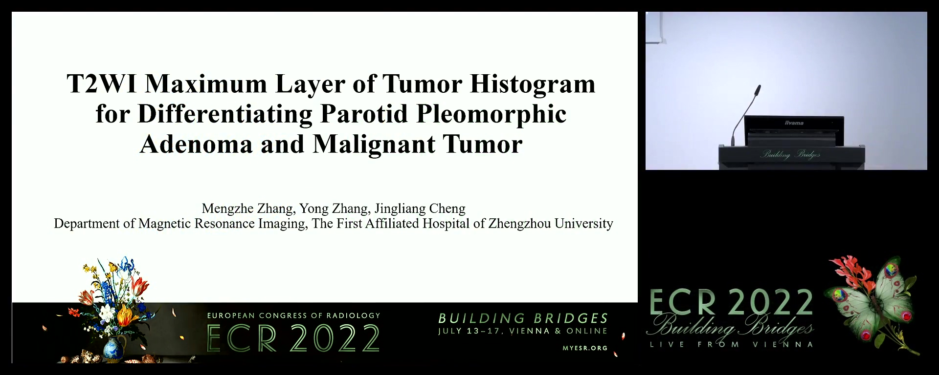 T2WI maximum tumour level histogram for differentiating parotid pleomorphic adenoma and malignant tumour - Mengzhe Zhang, Zhengzhou / CN