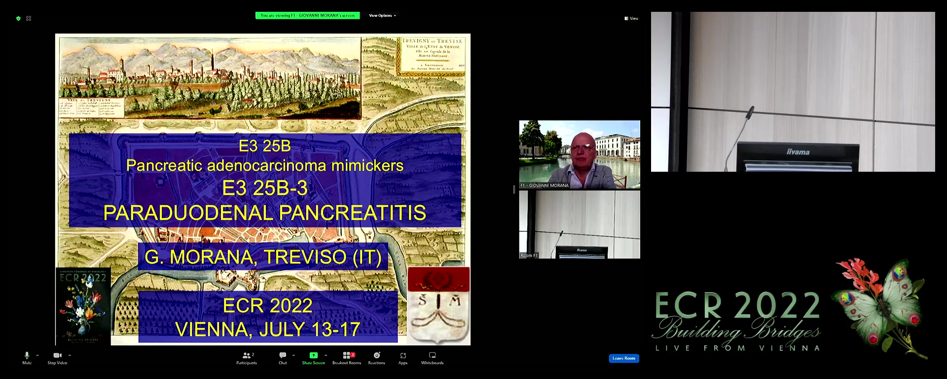 Paraduodenal pancreatitis