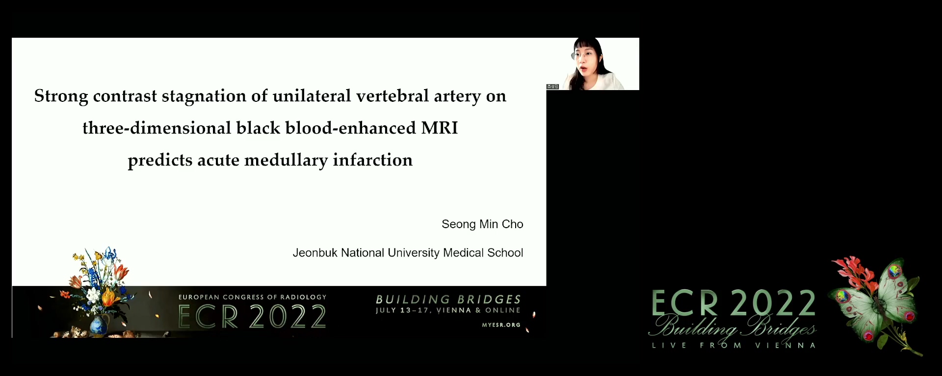 Strong contrast stagnation of unilateral vertebral artery on black blood enhanced MR imaging predicts acute medulla infarction