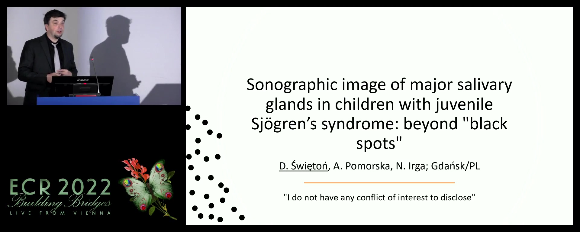 Sonographic image of major salivary glands in children with juvenile Sjögren’s syndrome: beyond 