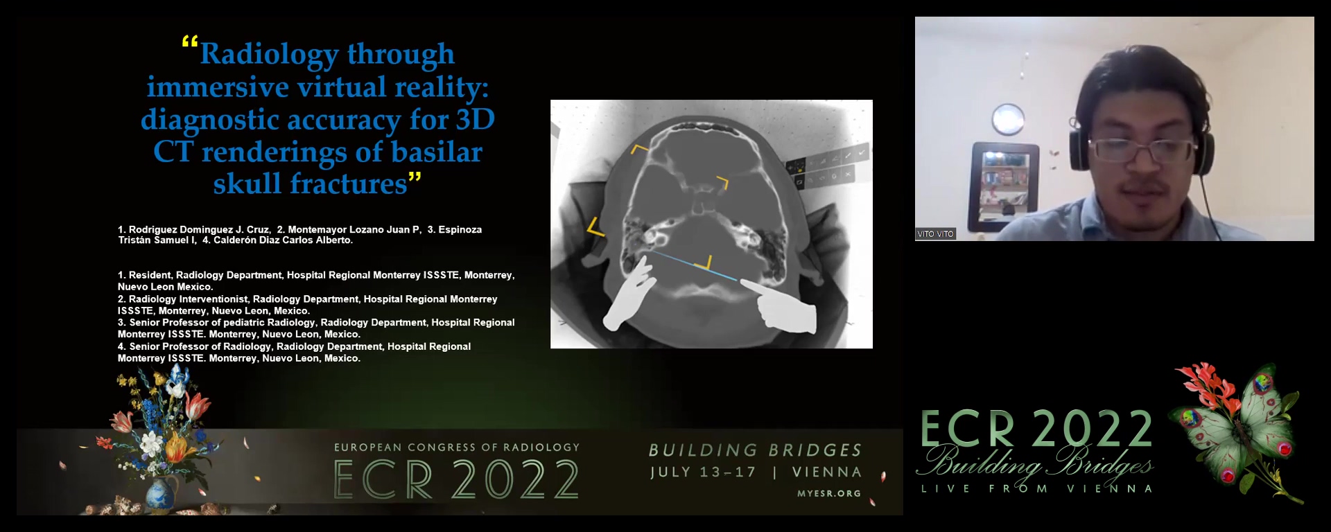 Radiology through immersive virtual reality: diagnostic accuracy for 3D CT renderings of basilar skull fractures