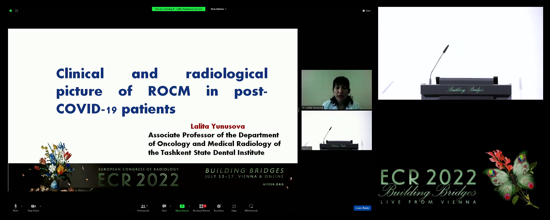 Clinical and radiological picture of ROCM in post-COVID-19 patients