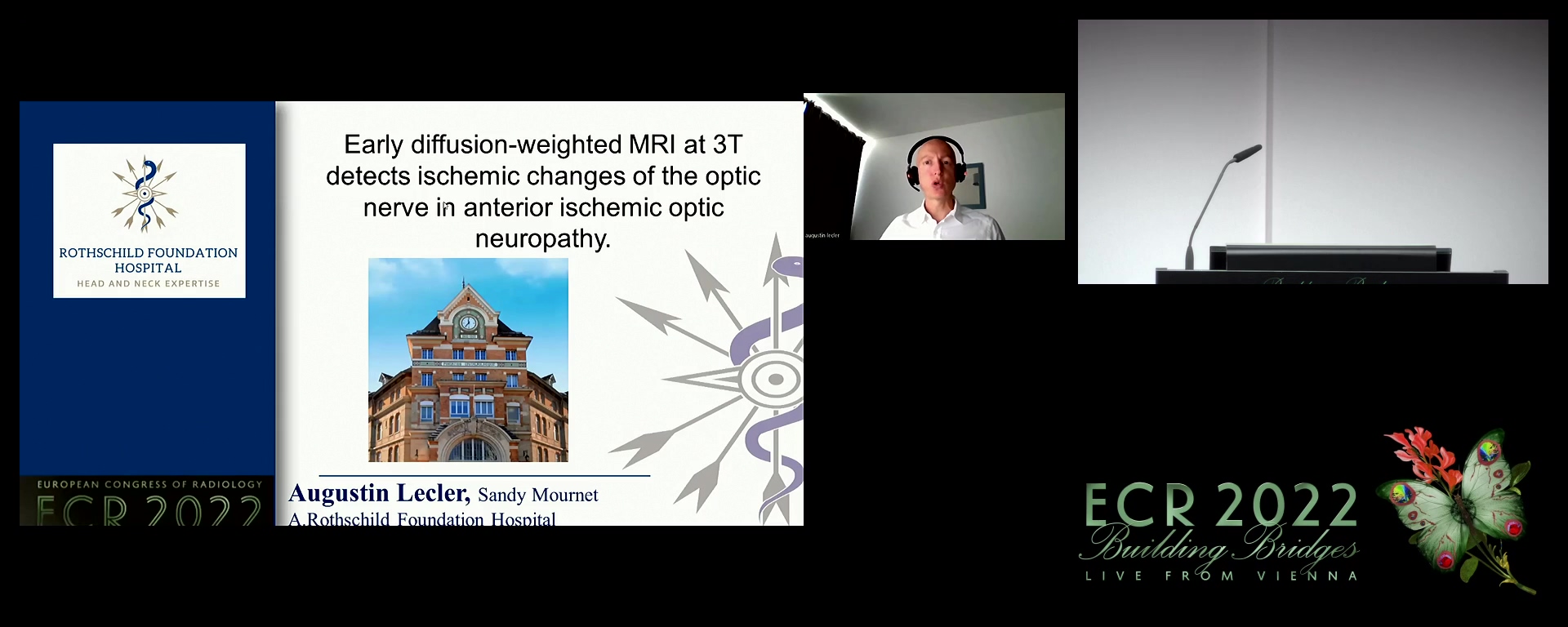 Early diffusion-weighted MRI at 3Tesla detects ischaemic changes of the optic nerve in anterior ischaemic optic neuropathy