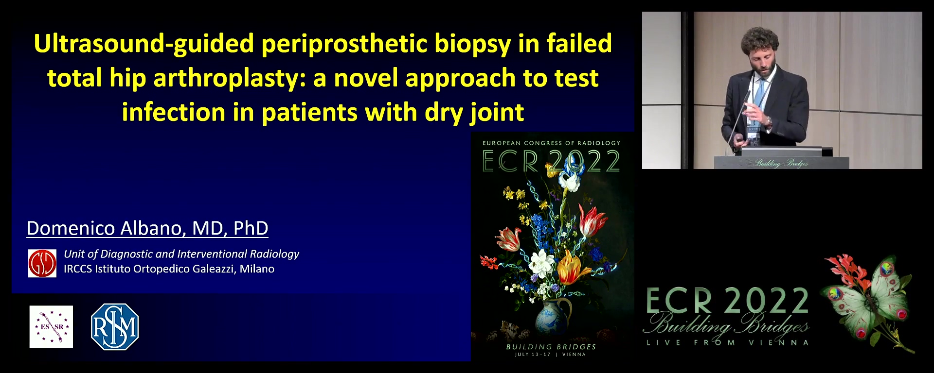 Ultrasound-guided periprosthetic biopsy in failed total hip arthroplasty: a novel approach to test infection in patients with dry joints